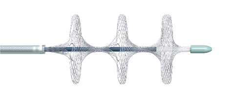 國內首創(chuàng)！本市研發(fā)生產的1款Ⅲ類創(chuàng)新醫(yī)療器械獲批上市，為具有溶栓禁忌癥的患者提供了治療選擇
